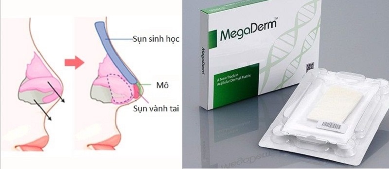  Bọc đầu mũi MegaDerm phù hợp với người có sức đề kháng kém