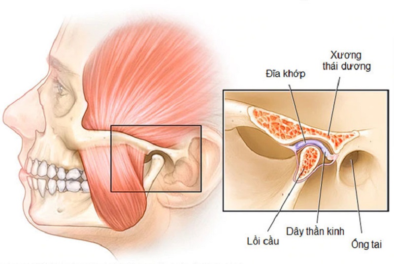 Sụn thái dương được dùng để tạo hình vùng đầu mũi