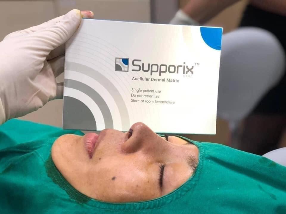 Meditab – đơn vị phân phối độc quyền bọc đầu mũi Supporix tại Việt Nam