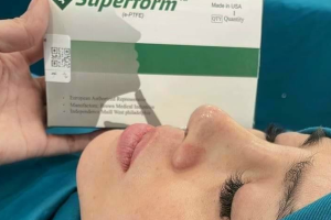 Sụn sinh học Superform là gì? Ưu và nhược điểm