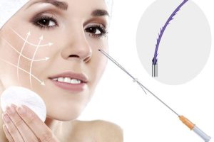 Căng da mặt bằng chỉ là gì? Có hiệu quả không?